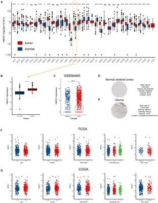 Heme Oxygenase-1 Predicts Risk Stratification and Immunotherapy Efficacy in Lower Grade Gliomas